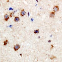 PPP1R14A / CPI-17 Antibody (N-Terminus)