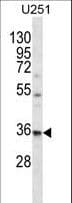 Polyclonal Rabbit anti-Human VPS37B Antibody (aa99-127, WB)