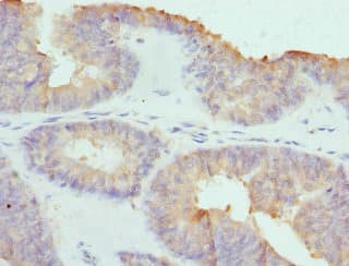 Polyclonal Rabbit anti-Human Cochlin / COCH Antibody (IHC)