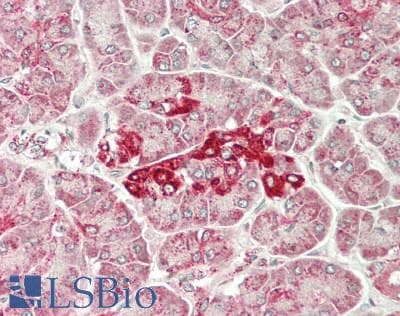 IHC-plus™ PCCB Antibody (aa289-539)