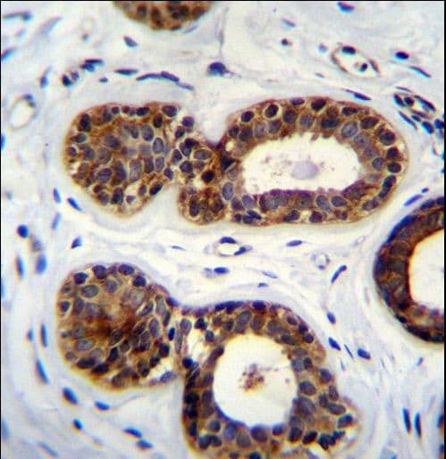 QTRTD1 Antibody (aa321-350)