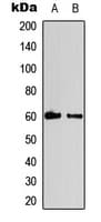 CCNB1 / Cyclin B1 Antibody (phospho-Ser147)