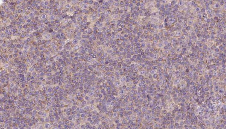 Polyclonal Rabbit anti-Human HPS5 Antibody (IHC, WB)