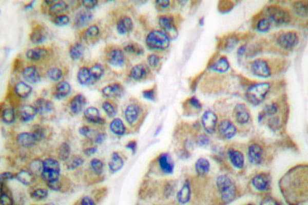 Polyclonal Rabbit anti-Human HSPE1 / HSP10 / Chaperonin 10 Antibody (Lys80, IHC, IF, WB)