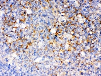 CD14 Antibody