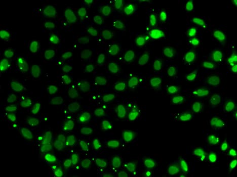 Polyclonal Rabbit anti-Human SUB1 Antibody (IHC, IF, WB)