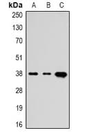 Monoclonal Mouse anti-Human TBP / GTF2D Antibody (WB)