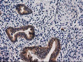 CTNNB1 / Beta Catenin Antibody (clone OTI6A3)