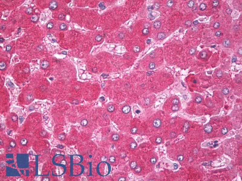 IHC-plus™ Polyclonal Rabbit anti-Human CANX / Calnexin Antibody (C-Terminus, IHC, IF, WB)