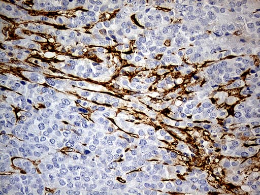 Monoclonal Mouse anti-Human MRC2 / Endo180 Antibody (clone OTI9G4, IHC, WB)