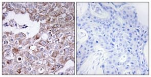 EMA / MUC1 Antibody (aa1191-1240)