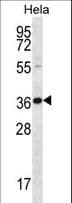 BTG3 Antibody (aa100-129)