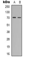 ZAP70 Antibody (phospho-Tyr319)