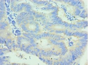 GLNRS / QARS Antibody (aa1-250)