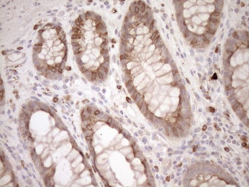 MLPH / Melanophilin Antibody (aa295-600, clone OTI6E8, Carrier-free)