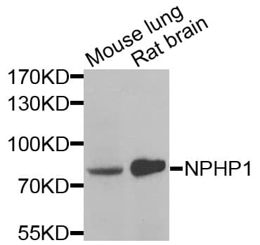 NPHP1 / Nephronophthisis Antibody (aa463-732)