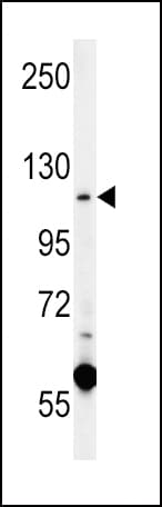 CACNA2D4 Antibody (aa89-118)