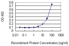 SHOX2 Antibody (aa117-204, clone 1D1)
