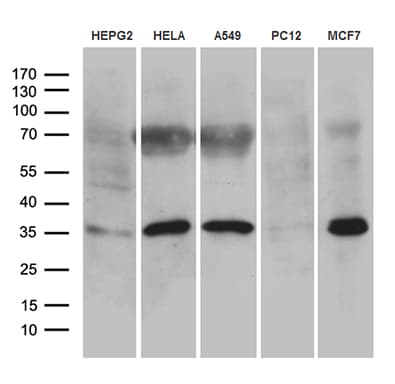 Monoclonal Mouse anti-Human USB1 Antibody (clone OTI1B1, WB)