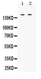 ABL1 / c-ABL Antibody (aa1020-1049)