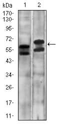 Monoclonal Mouse anti-Human CA9 / Carbonic Anhydrase IX Antibody (clone 10F7A8, aa37-186, WB)