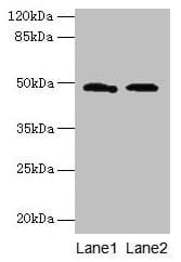 surA Antibody (aa21-428)