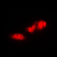 RPS6KB1 / P70S6K / S6K Antibody (C-Terminus)