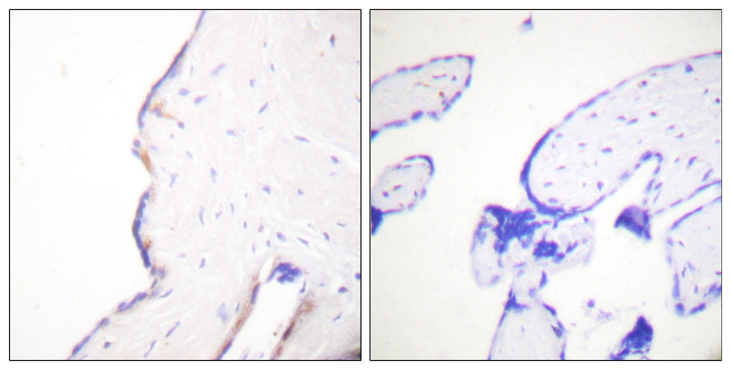 MSN / Moesin Antibody (p558)
