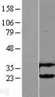 UBCH / UBE2H Protein (Over-Expression Lysate Myc-DDK (Flag))