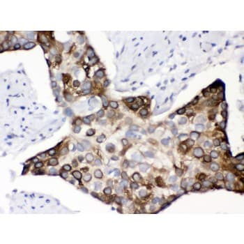 KIN17 / KIN Antibody (aa3-202)