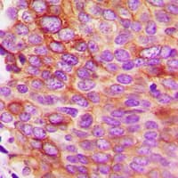 IL5 Antibody (Internal)
