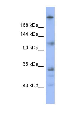 Polyclonal Rabbit anti-Human KNTC1 / ROD Antibody (N-Terminus, WB)