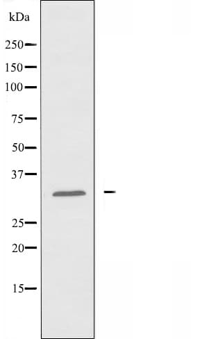 ATF5 Antibody