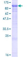 Human SYVN1 / HRD1 Protein (Recombinant GST)