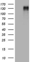 Monoclonal Mouse anti-Human EGFR Antibody (clone OTI2E1, aa900-1210, WB)
