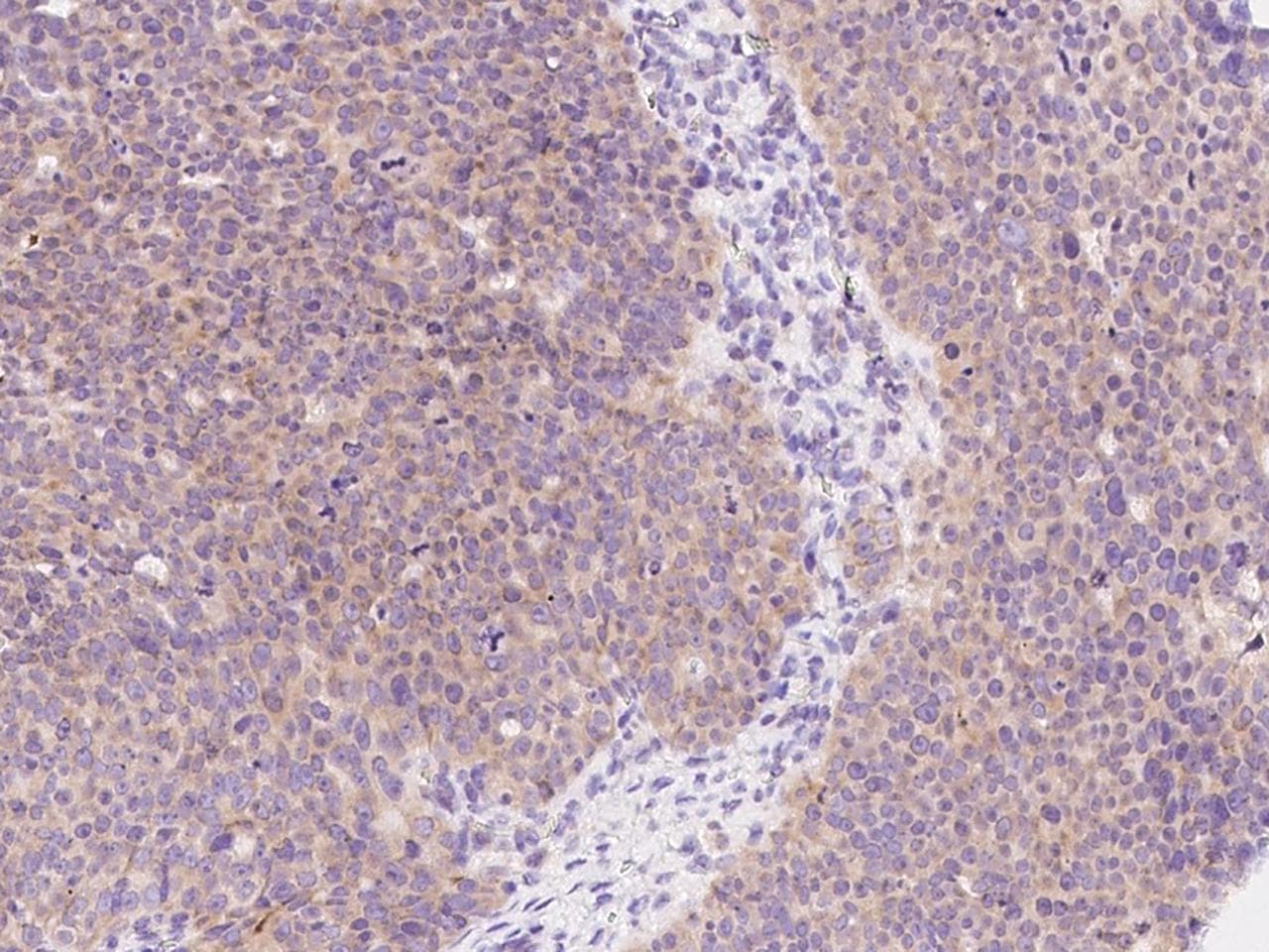MCL1 / MCL 1 Antibody (Preservative Free)