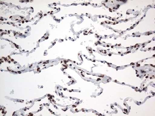 EWSR1 / EWS Antibody (aa256-447, clone OTI2B3)