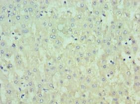 IL13RA2 / IL13R Alpha 2 Antibody (aa27-343)