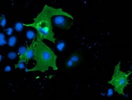 SH2B3 / LNK Antibody (clone OTI2C9)