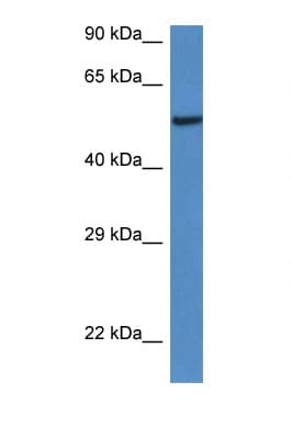Polyclonal Rabbit anti-Mouse LACC1 Antibody (C-Terminus, WB)