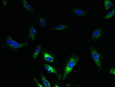 Polyclonal Rabbit anti-Human SLC17A3 Antibody