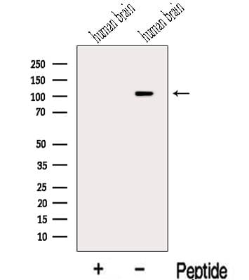 Polyclonal Rabbit anti-Human MAP3K10 / MLK2 Antibody (WB)