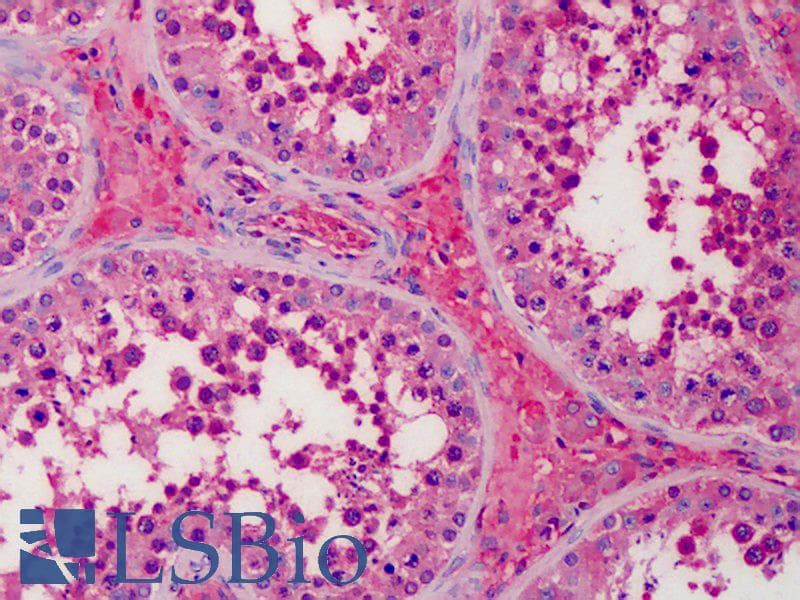IHC-plus™ Polyclonal Rabbit anti-Human Apolipoprotein A-II Antibody (IHC, WB)