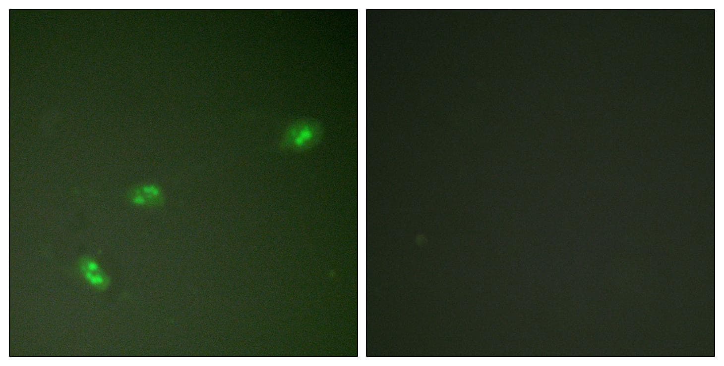 NPM1 / NPM / Nucleophosmin Antibody (phospho-Thr199)