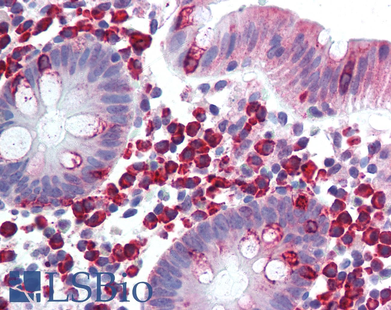 IHC-plus™ LTK Antibody (aa800-864)