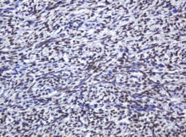 ZSCAN18 / ZNF447 Antibody (clone OTI4D1)