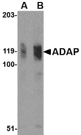 ADAP / FYB Antibody