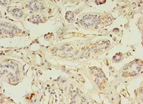 ZNF266 Antibody