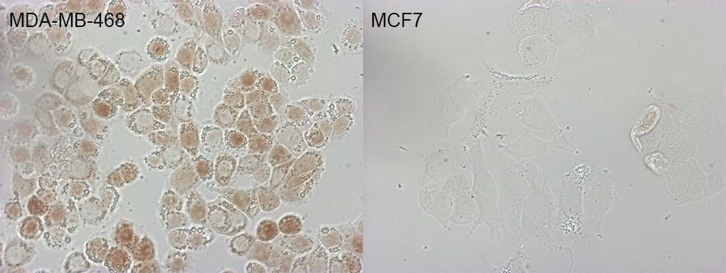 p16INK4a / CDKN2A Antibody (clone OTI3G3)