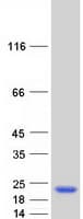 Human TRAPPC3 Protein (Recombinant Myc-DDK (Flag))